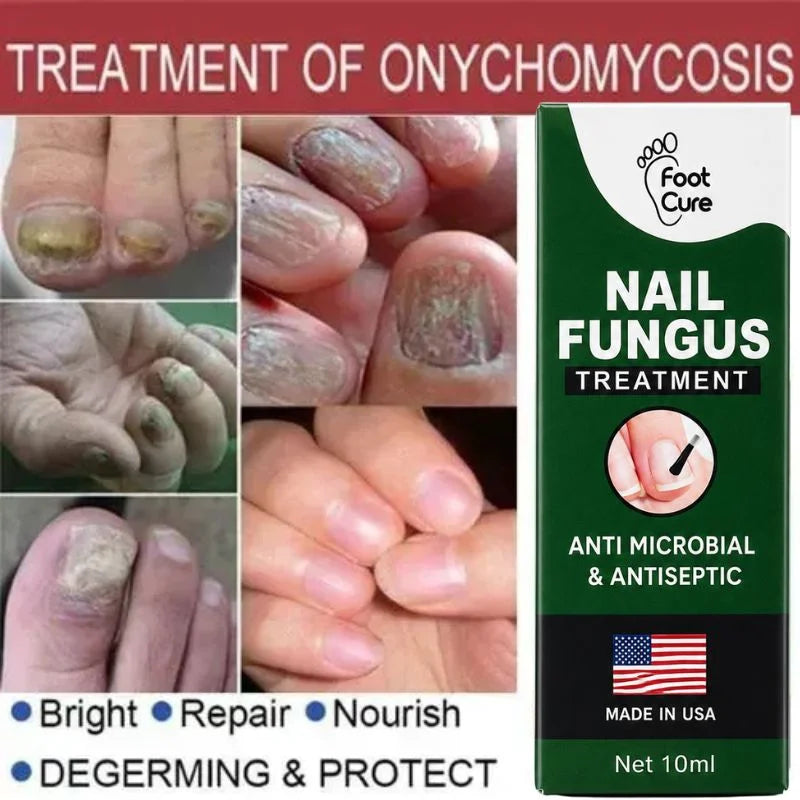 Fast Nail Fungu Fingernails & Toenails | Natural Nail Care Formula