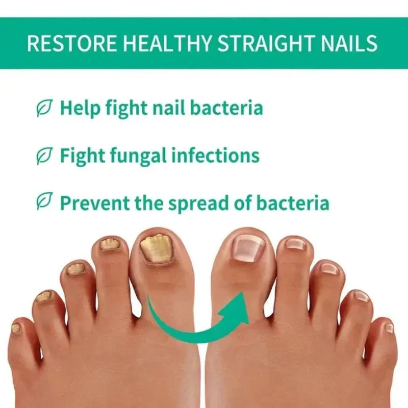 Fast Nail Fungu Fingernails & Toenails | Natural Nail Care Formula