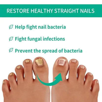 Fast Nail Fungu Fingernails & Toenails | Natural Nail Care Formula