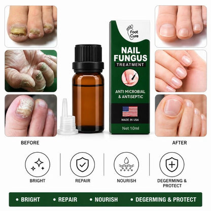 Fast Nail Fungu Fingernails & Toenails | Natural Nail Care Formula
